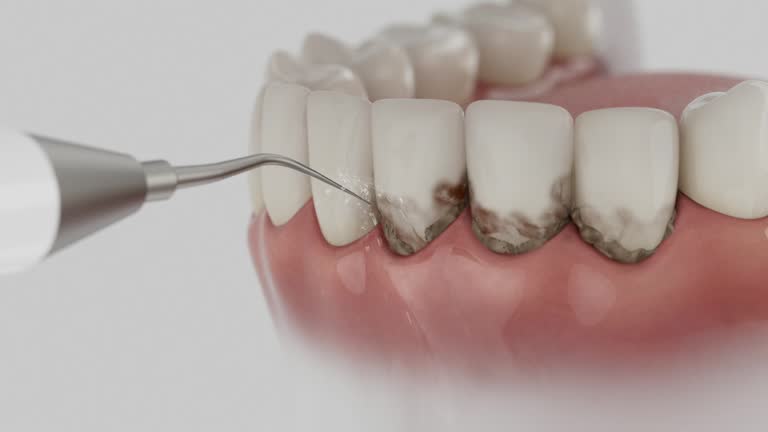 Trusted Teeth Whitening service in Pineville, KY - Dentist Open Now